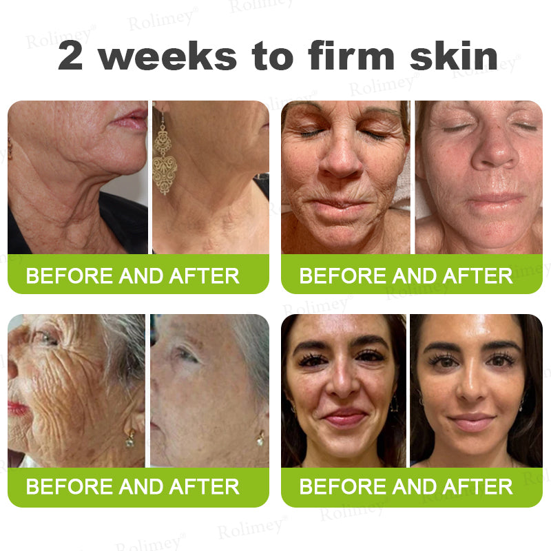 🌿Wrinkle-Lift Tightening stick