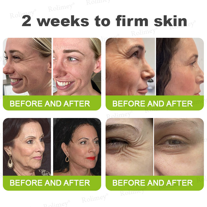 🌿Wrinkle-Lift Tightening stick
