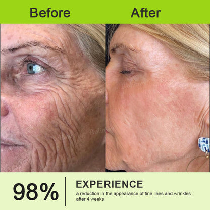 🌿Wrinkle-Lift Tightening stick