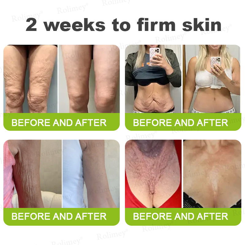 🌿Wrinkle-Lift Tightening stick